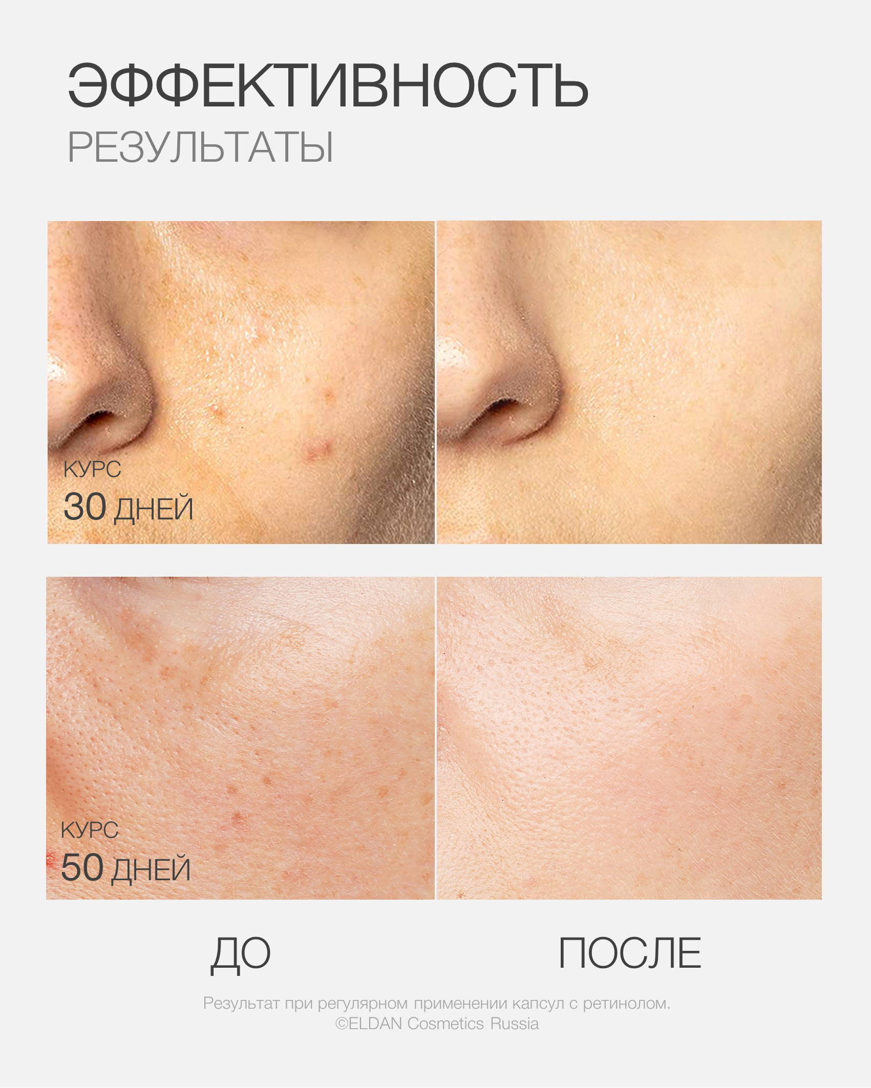 Пост капсулы ретинол 5.jpg Пост капсулы ретинол 5.jpg